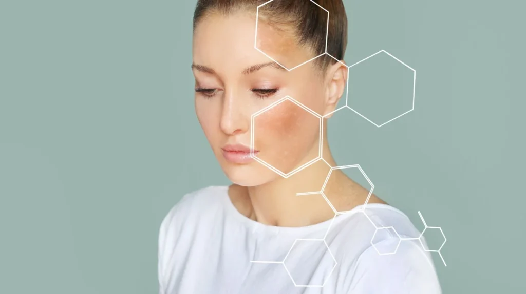 Một số trường hợp xuất hiện hiện tượng nám da do hormone kích thích tế bào sắc tố hoạt động mạnh hơn